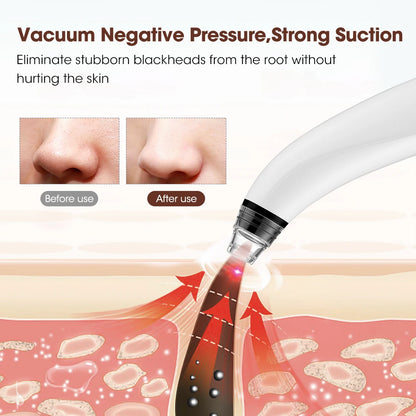 Multifunctional Beauty Pore Vacuum 4 in 1