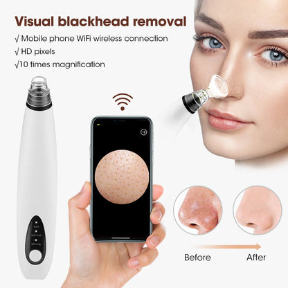 Multifunctional Beauty Pore Vacuum 4 in 1